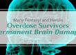 Many Fentanyl and Heroin Overdose Survivors Suffering Permanent Brain Damage